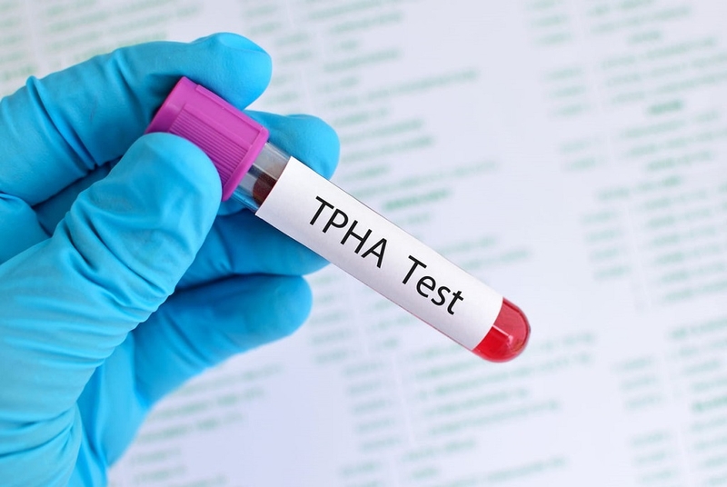 Xét nghiệm RPR và TPHA là gì? Tìm hiểu ưu nhược điểm của hai phương pháp 4