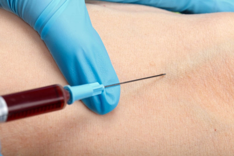 Xét nghiệm sán chó có cần nhịn ăn không?-2