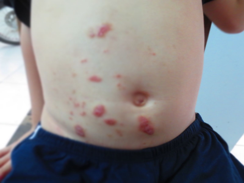 Xét nghiệm sán chó có cần nhịn ăn không?-3