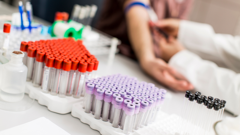 NIPT là xét nghiệm hiện đại, an toàn và có độ chính xác cao