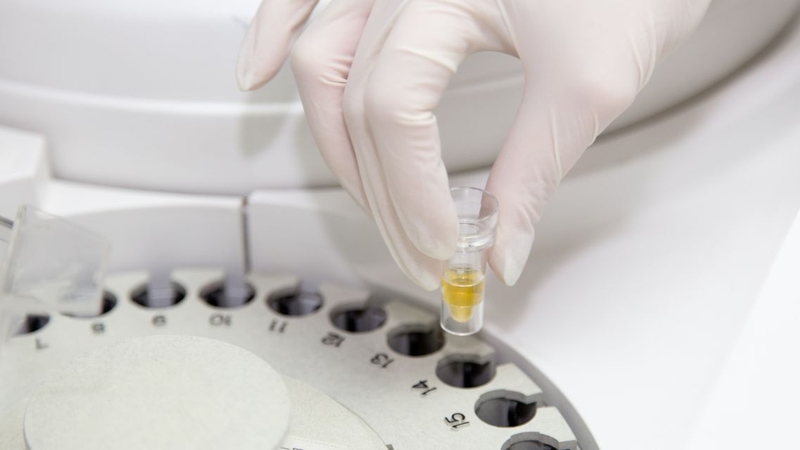 Có nhiều chỉ số khác nhau trong loại xét nghiệm này