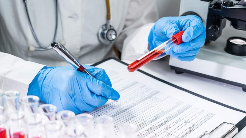 Xét nghiệm sinh sợi huyết trong đánh giá khả năng đông và cầm máu 3