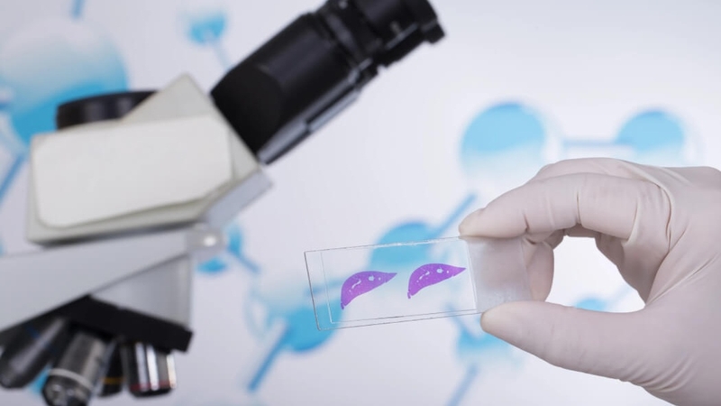 Xét nghiệm sinh thiết bao lâu có kết quả? 1