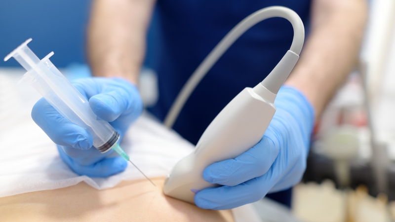 Xét nghiệm sinh thiết giá bao nhiêu tiền phụ thuộc vào loại kỹ thuật, vị trí lấy mẫu, mức độ phức tạp và các dịch vụ đi kèm