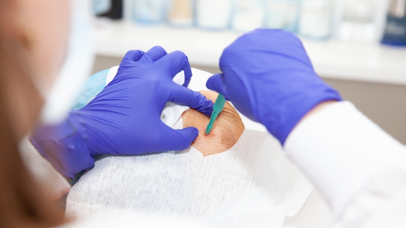 Xét nghiệm sinh thiết sẽ được bảo hiểm y tế (BHYT) chi trả nếu đáp ứng đầy đủ các điều kiện theo quy định