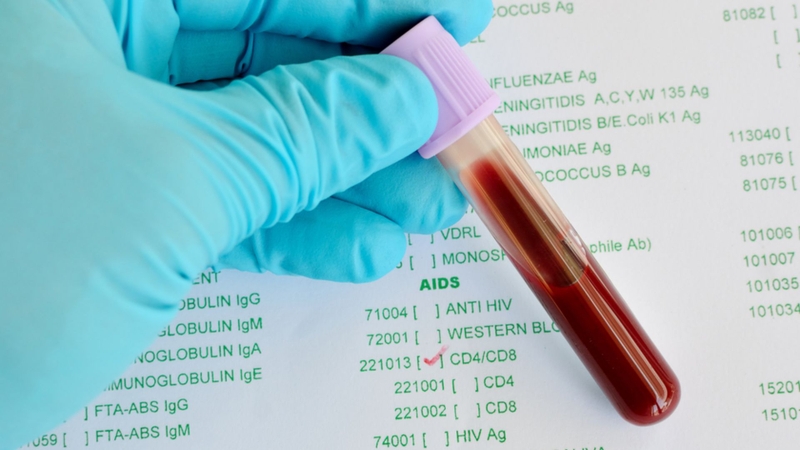 Xét nghiệm số lượng tế bào CD4 để làm gì? 4