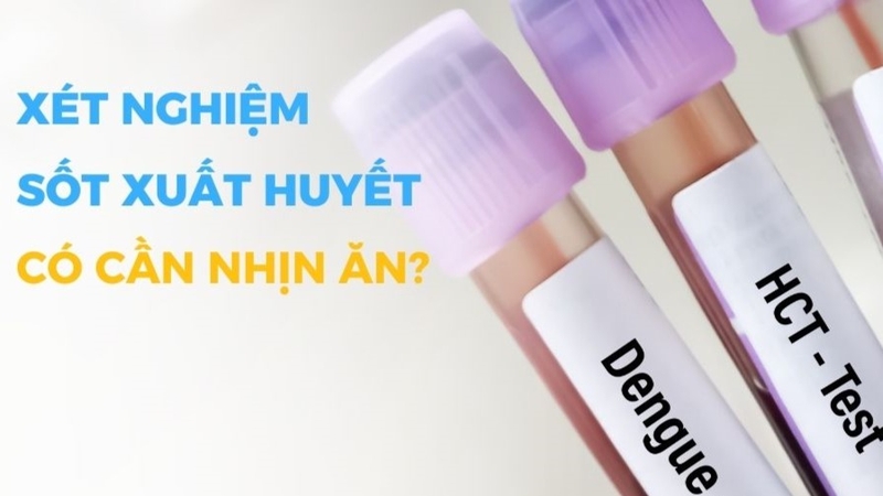 Xét nghiệm sốt xuất huyết có cần nhịn ăn không? 2