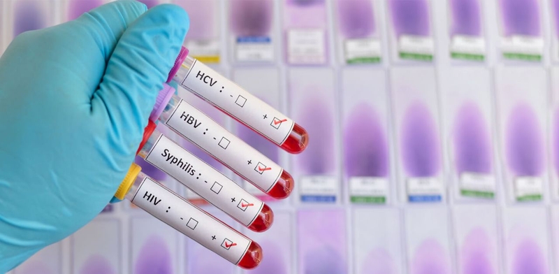 Xét nghiệm STI là gì? Những loại xét nghiệm STI phổ biến hiện nay