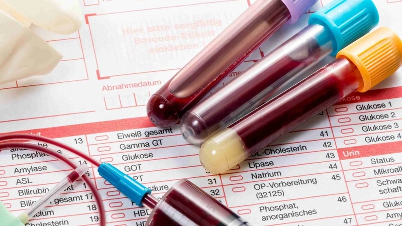 Xét nghiệm sức bền hồng cầu là gì? Ý nghĩa kết quả xét nghiệm sức bền hồng cầu 1