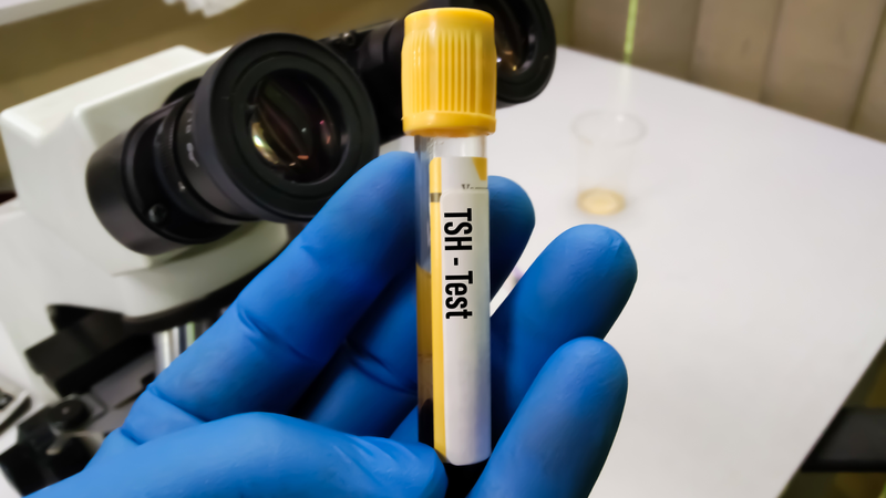 Xét nghiệm suy giáp: Vai trò quan trọng trong chẩn đoán và theo dõi bệnh lý tuyến giáp 1