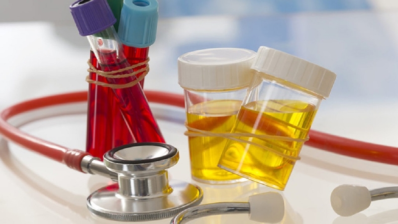 Xét nghiệm máu giúp đo nồng độ creatinin