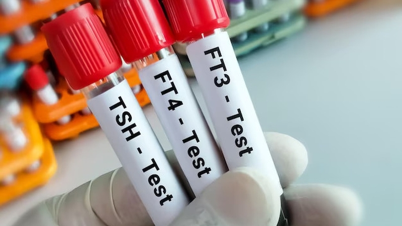 Xét nghiệm T3 T4 TSH là gì? Ý nghĩa các chỉ số xét nghiệm tuyến giáp 2