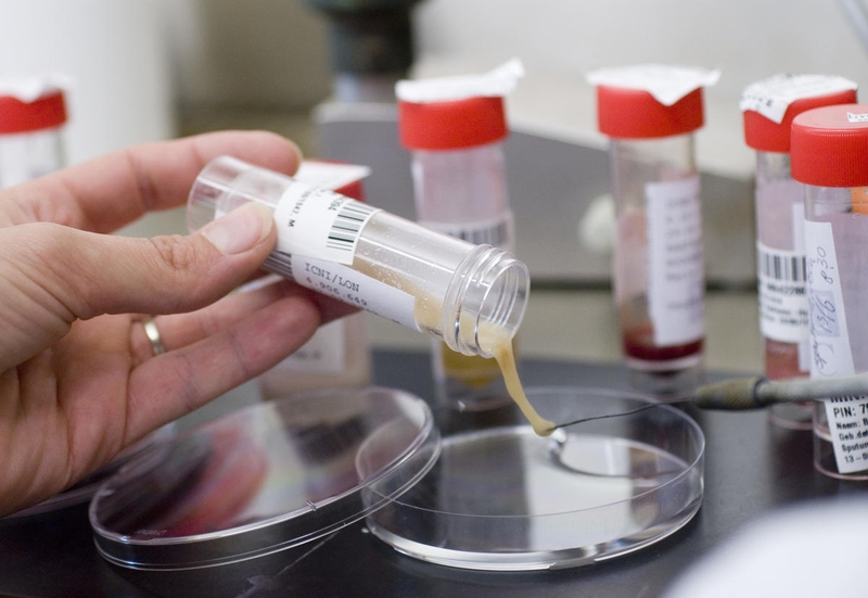 Xét nghiệm tầm soát ung thư phổi bao nhiêu tiền? có đắt không? 1