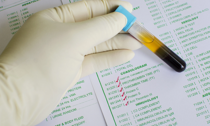 Xét nghiệm TCK được thực hiện như thế nào? 3