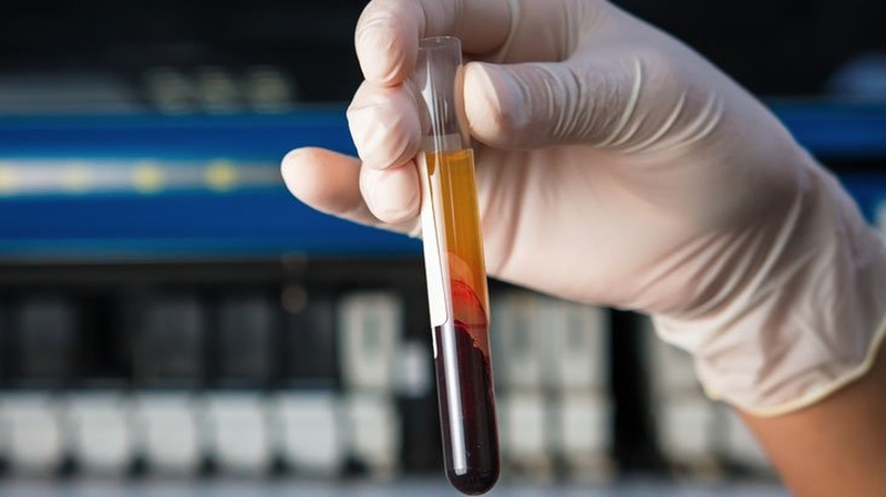 Xét nghiệm TCK là gì? Vai trò của TCK trong chẩn đoán rối loạn đông máu 2