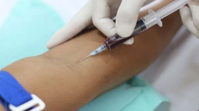 Xét nghiệm TCK là gì? Vai trò của TCK trong chẩn đoán rối loạn đông máu 3