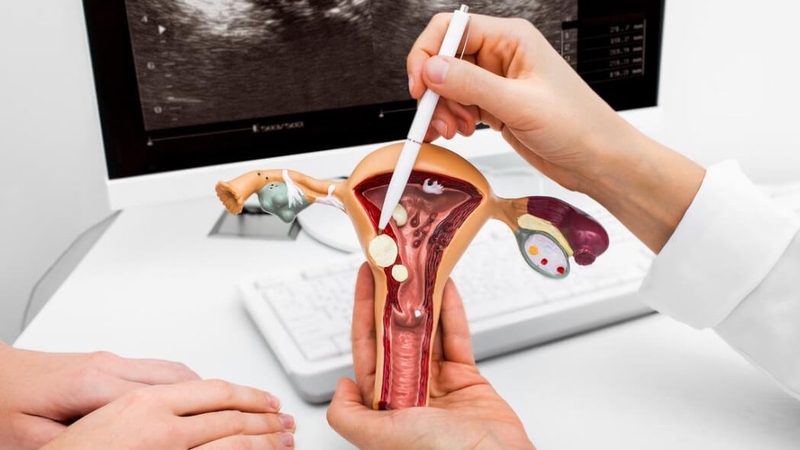 Xét nghiệm tế bào học bằng phương pháp Liqui Prep là gì? Khi nào cần xét nghiệm? 1