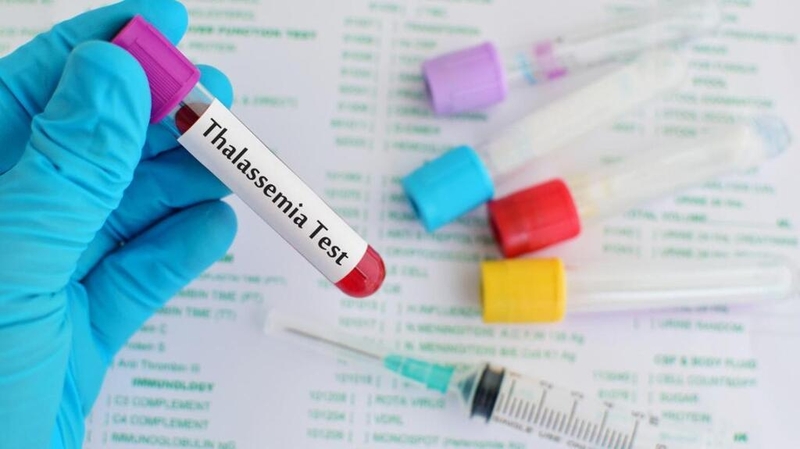 Xét nghiệm Thalassemia có mất thời gian không? 3