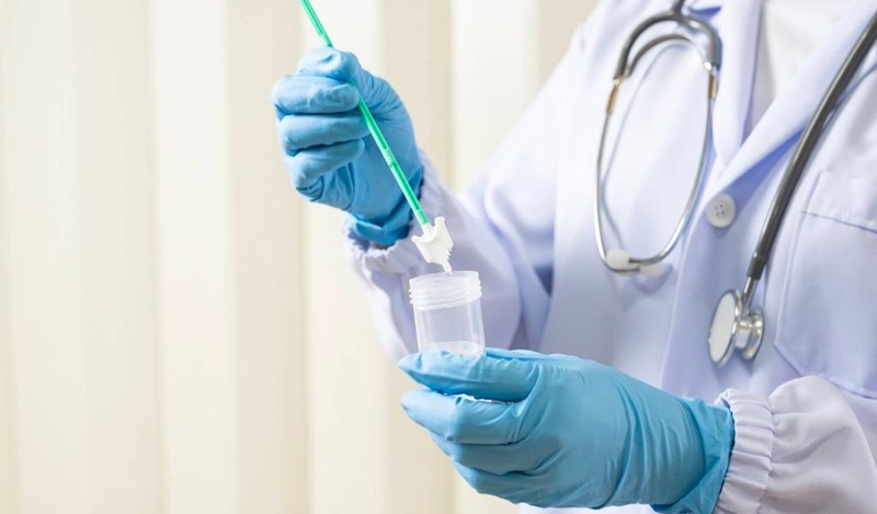 Xét nghiệm Thinprep là gì? Nên thực hiện vào lúc nào? 1