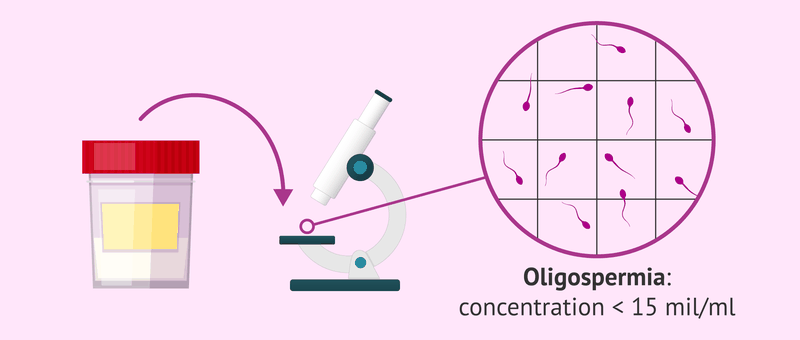 Xét nghiệm tinh dịch đồ bao nhiêu tiền? Bao lâu có kết quả? 4