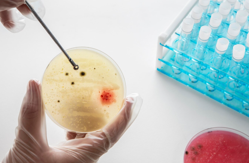 Xét nghiệm tinh dịch đồ có cần thiết không? Những điều cần biết về xét nghiệm tinh dịch đồ 1