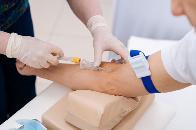 Xét nghiệm tổng phân tích tế bào máu để làm gì? 2