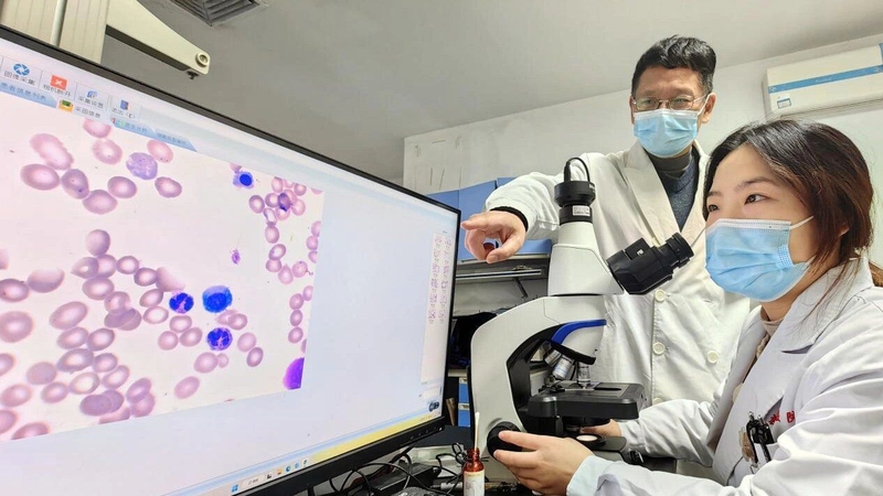 Xét nghiệm tổng phân tích tế bào máu để làm gì? 4