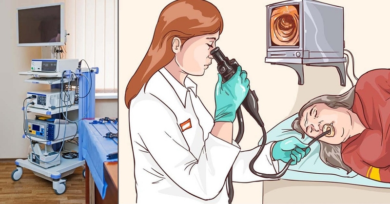 Điểm mặt các phương pháp xét nghiệm trào ngược dạ dày 1