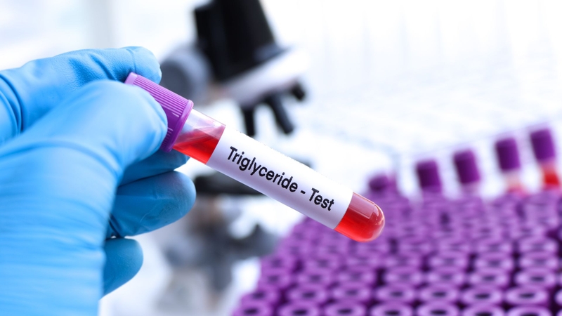 Xét nghiệm triglyceride chẩn đoán bệnh gì và cách đọc kết quả xét nghiệm 2
