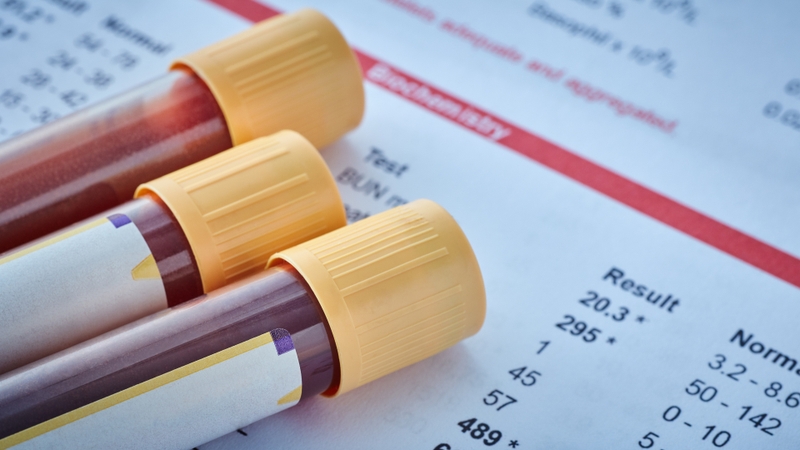 Xét nghiệm Triple Test là gì? Những thông tin bạn cần biết về xét nghiệm Triple Test 3