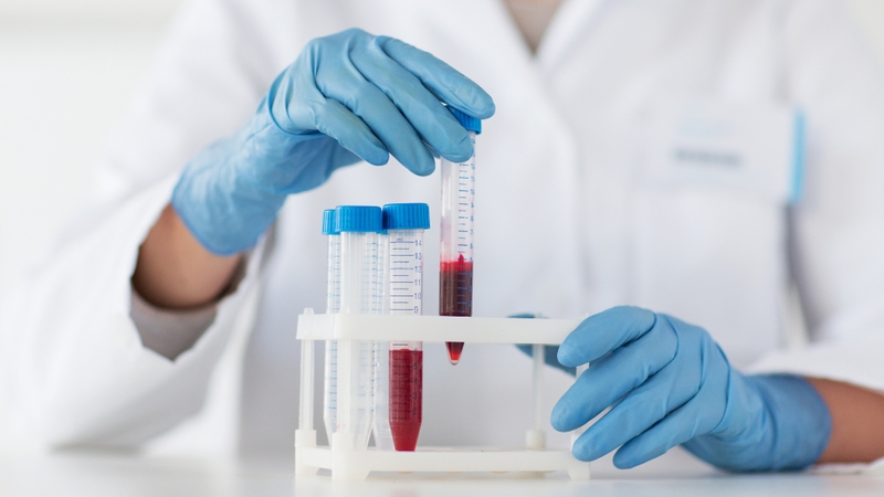 Xét nghiệm Triple Test là gì? Những thông tin bạn cần biết về xét nghiệm Triple Test 4