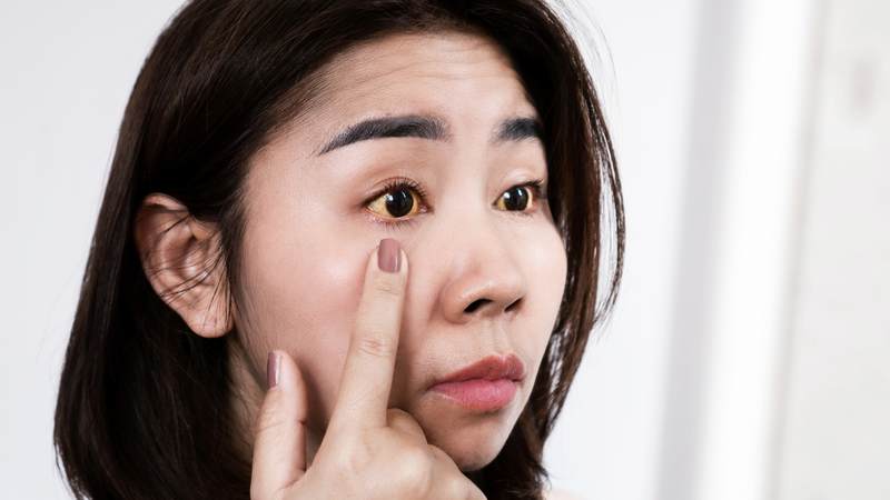 Xét nghiệm ung thư gan bao gồm những gì?