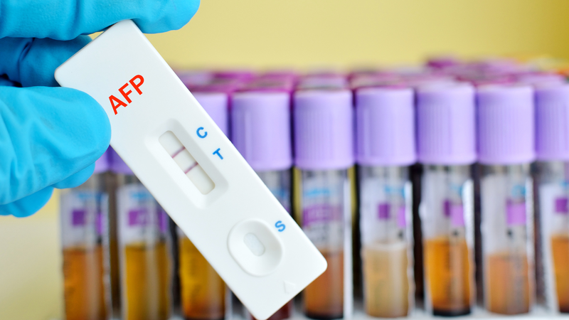 Xét nghiệm ung thư gan bao gồm những gì?