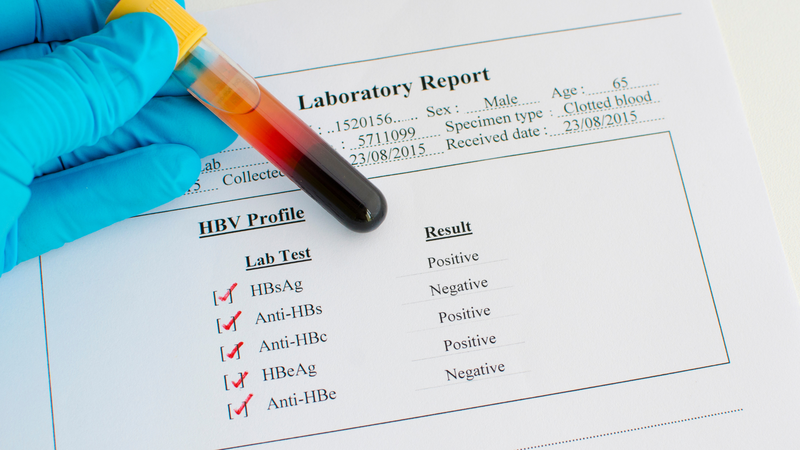 Xét nghiệm viêm gan B là gì?