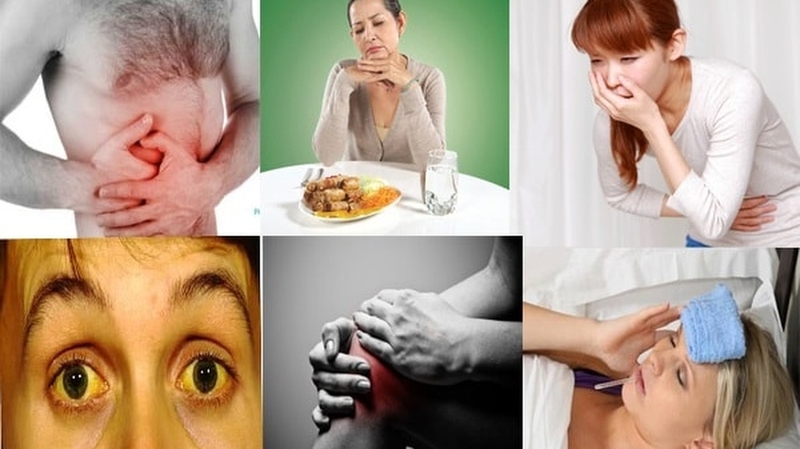 Xét nghiệm viêm gan C bao nhiêu tiền? Những thông tin bạn cần biết 1