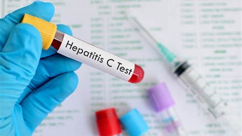 Xét nghiệm viêm gan C bao nhiêu tiền? Những thông tin bạn cần biết 2