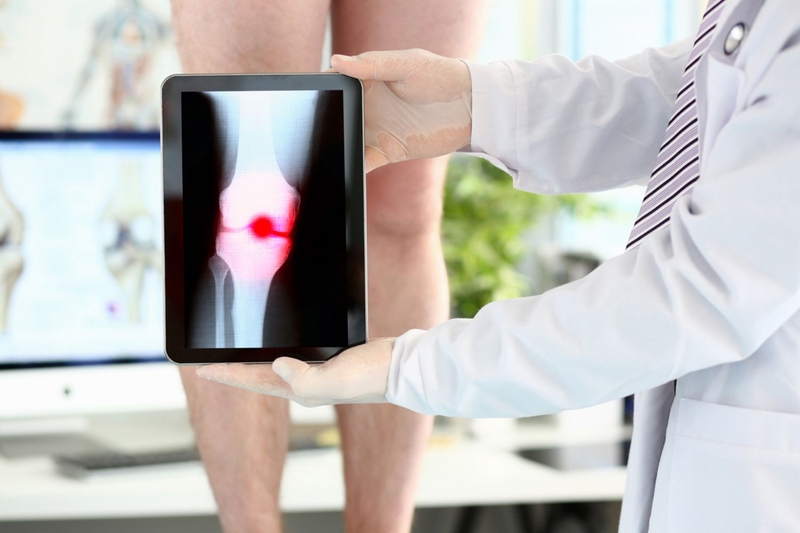 Xét nghiệm viêm khớp dạng thấp gồm những gì? Khi nào cần thực hiện? 3