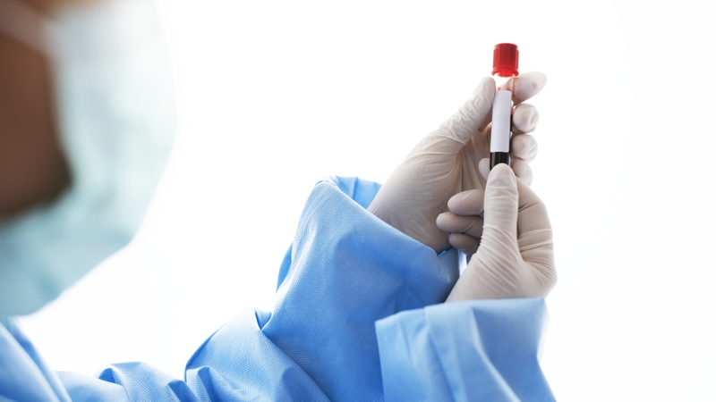 Xét nghiệm máu đánh giá tình trạng viêm được xem là nền tảng trong chẩn đoán