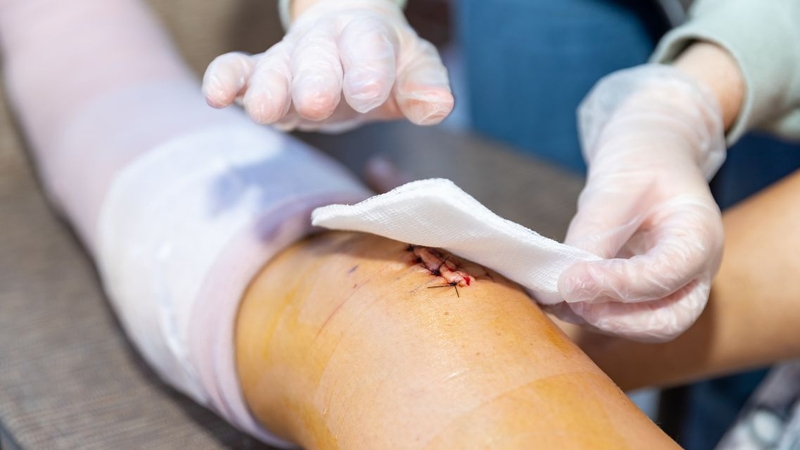 Có nhiều nguyên nhân khác nhau, gây ra các loại vết thương khác nhau