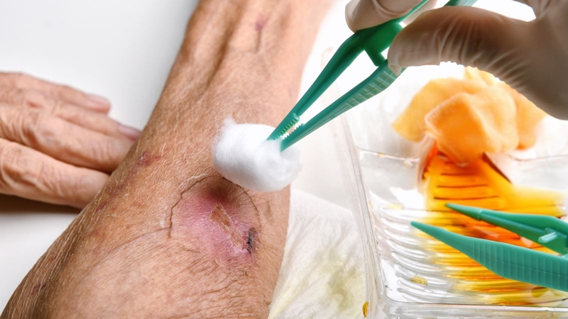 Chăm sóc đúng cách giúp vết thương nhanh lành