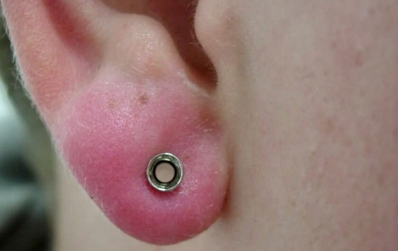 Sau khi xỏ khuyên có được ăn bánh mì không? 3