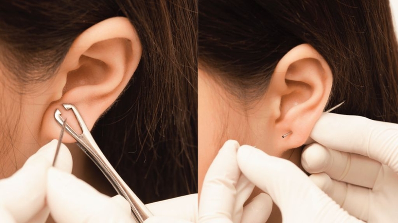 Xỏ khuyên có được ăn hải sản không? Ăn gì để nhanh hồi phục? 1