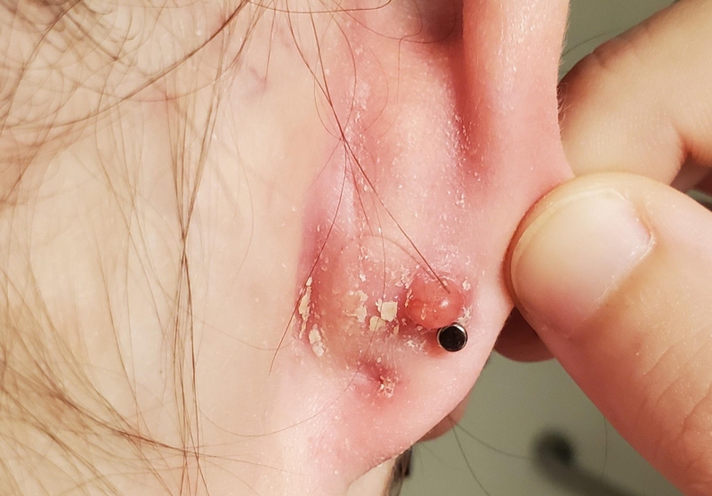 Xỏ khuyên có được uống bia không? 1