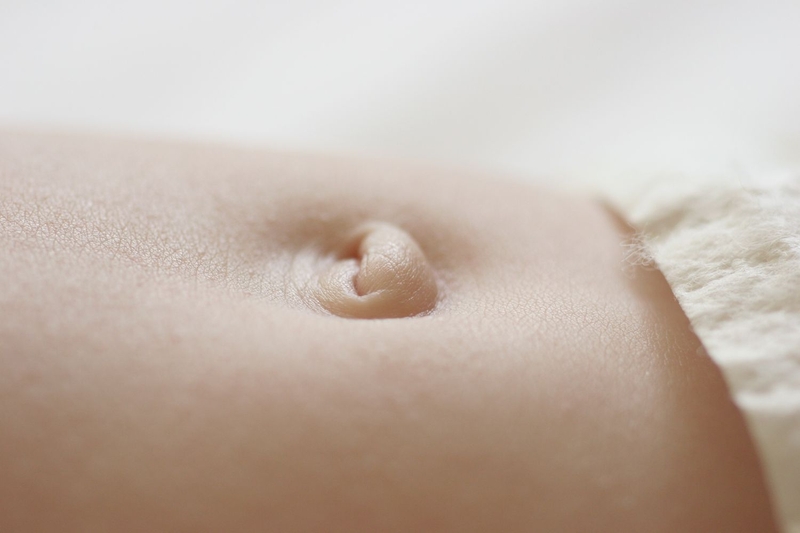 Xỏ khuyên rốn bị lồi thịt xử lý thế nào 1