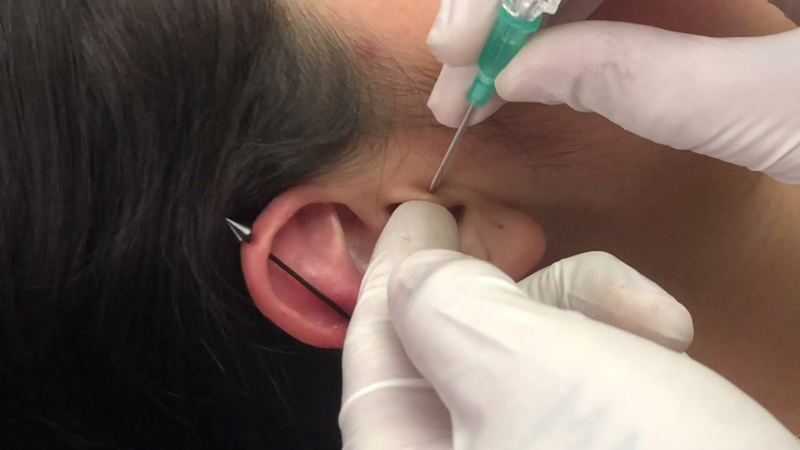 Xỏ khuyên và bấm khuyên cái nào đau hơn? Những nguy cơ nào có thể gặp phải?4