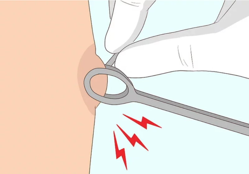 Xỏ khuyên vú: Những điều nên biết trước khi thực hiện 1