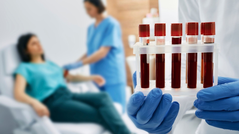 Xơ vữa động mạch chủ bụng: Nguyên nhân, triệu chứng và phương pháp điều trị 3