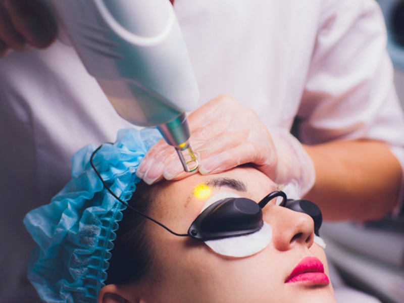 Sau khi xóa laser lông mày bị đỏ - Phải làm sao 1