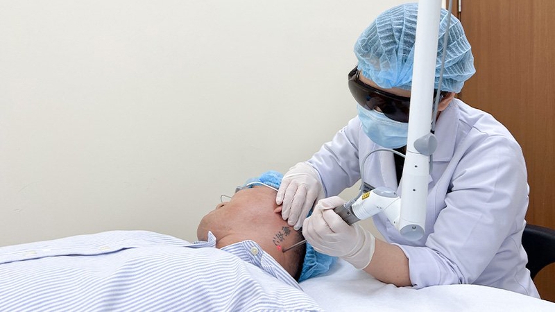 Xóa xăm bao nhiêu tiền? 1