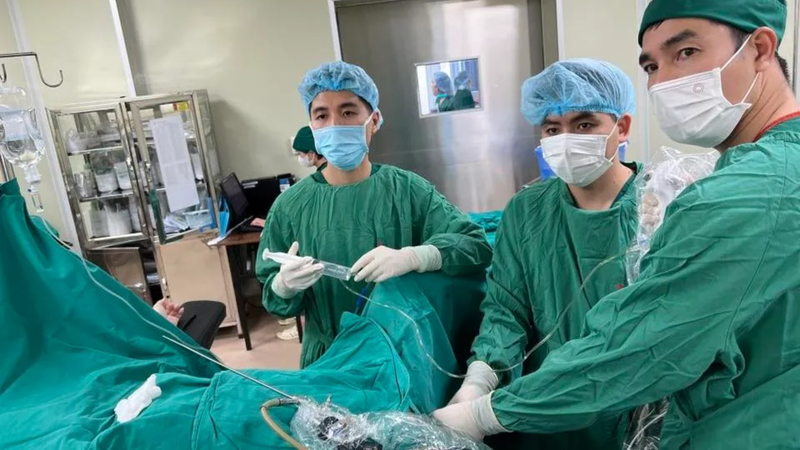 Khó khăn xuất hiện ngay khi các bác sĩ đưa ống soi tiếp cận vị trí sỏi
